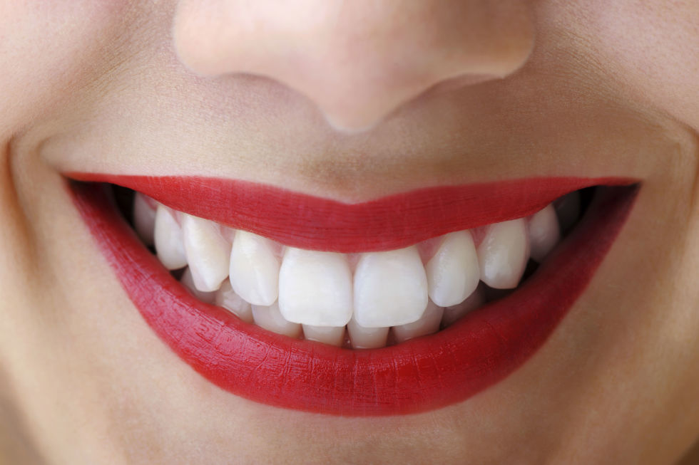 Teeth Whitener