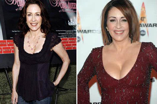 Patricia Heaton Tit Pics Hot Porno