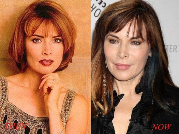 Lauren Koslow